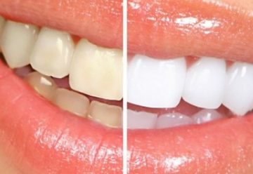 Como mejorar tu higiene dental de forma natural