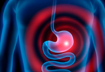 La Gastritis y Tratamientos Naturales